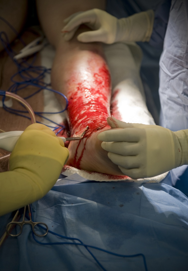 Ein Chirurg mit Handschuhen verwendet medizinische Scheren während einer Operation an einem Patienten, wobei umgebende medizinische Geräte zu sehen sind.