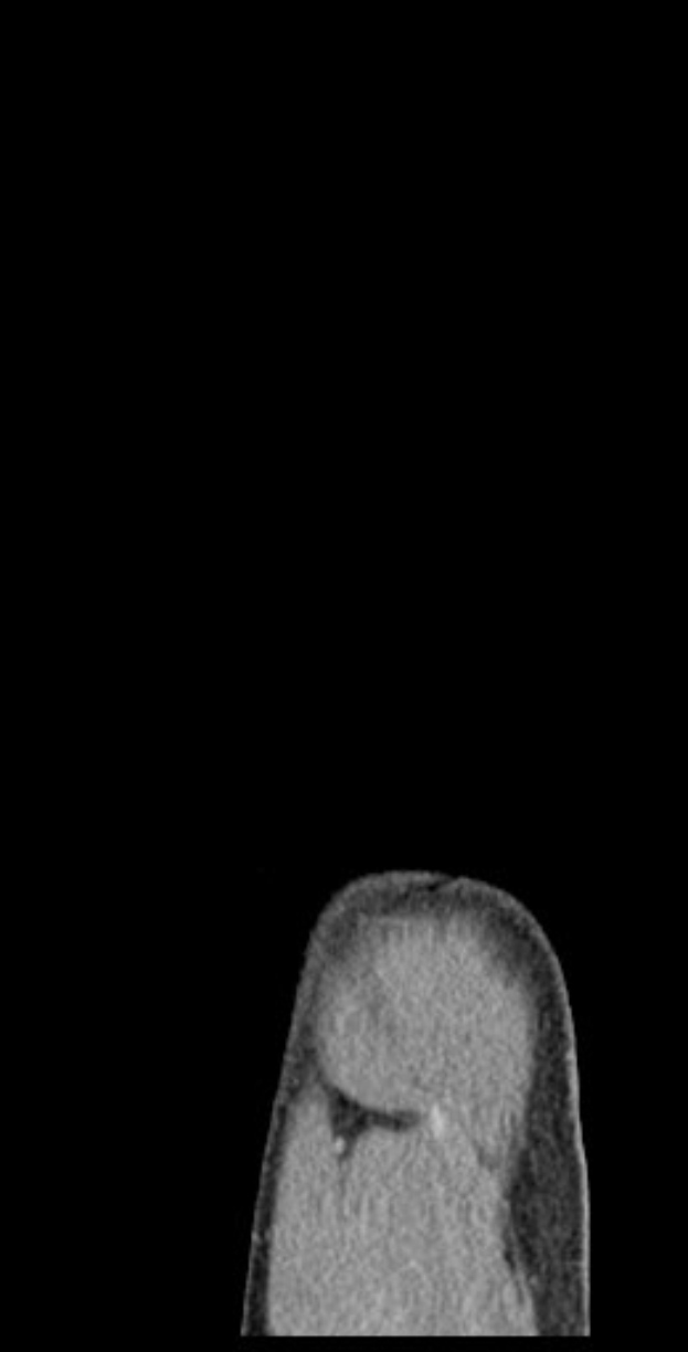 Schwarze und weiße MRI-Aufnahme eines Mannes, die detaillierte Gehirnstruktur zeigt.