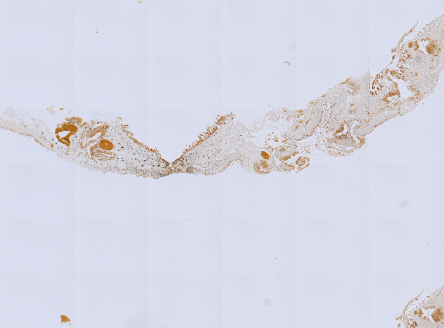 Mikroskopisches Bild einer formalin/PFA-fixierten Paraffin-embedded Gewebeschnitt, der mit Anti-PFA1-Antikörper (EPR22828) und BSA angefärbt ist.
